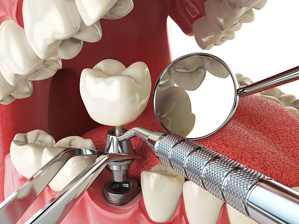 Best Emergency Dental Services for Seniors in Gilcrest, CO